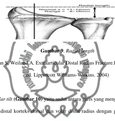 Gambar 9. Radial length  