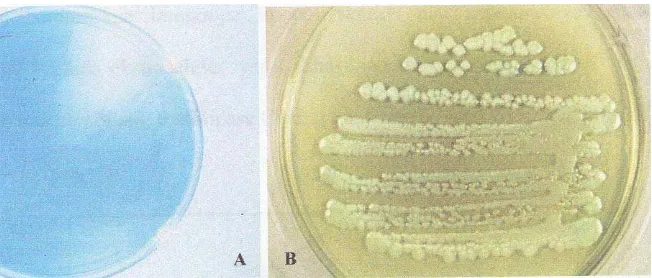 Gambar 2. A. Pigmen piosianin dihasilkan banyak strain. B. Koloni Pseudomonas aeruginosa pada agar 1