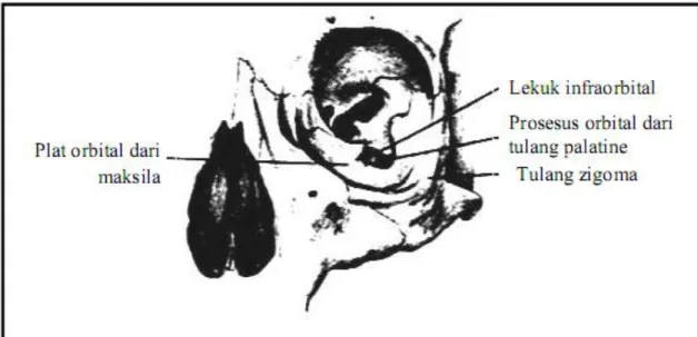 Gambar 8. Dinding Inferior dari Orbita (Robert, 1984) 