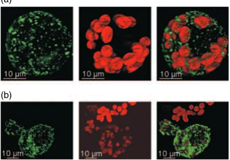 Figure 2. Subcellular localization of PpTSPO1. Physcomitrella patens proto-plasts were transfected with a PpTSPO1::GFP C-terminal fusion construct