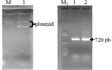 Gambar 3 Penampilan koloni E. coli DH5α yang diduga membawa plasmid rekombinan (koloni putih) pada media seleksi (ampisilin, X-gal, dan IPTG)   
