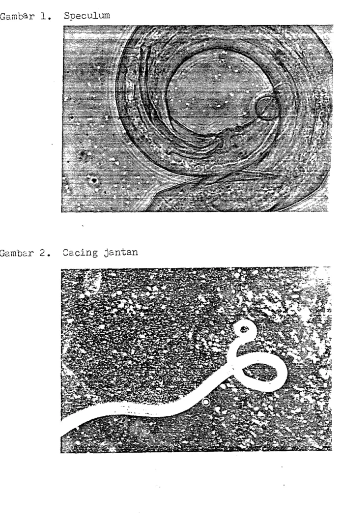 Gambar  1.  Speculum 