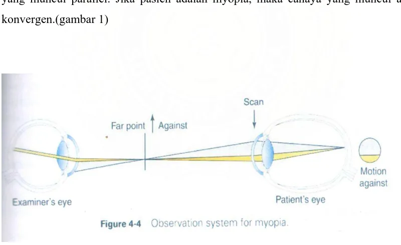 Gambar 1 : Sistem observasi untuk myopia( from fig. 4-4 American Academi of Ophthalmology, Clinical Optics, 2008-2009, p.127) 