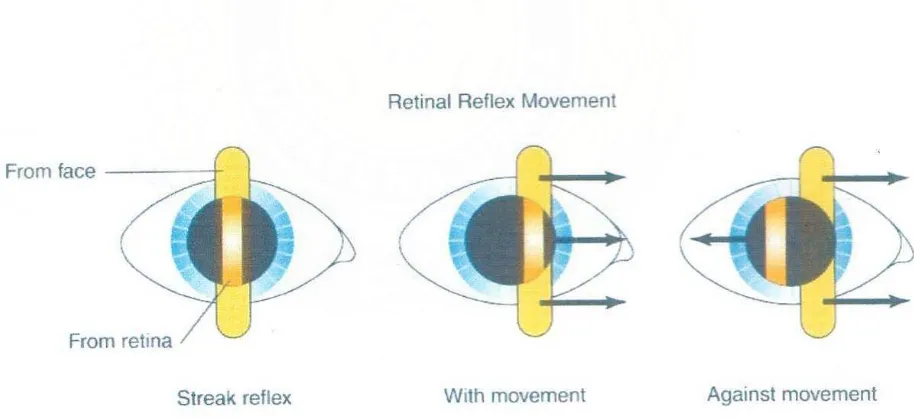 Gambar 2 : Gerakan refleks retina. Perhatikan gerakan lintasan dari wajah dan dari 