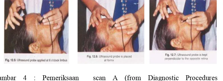Gambar 4 : Pemeriksaan  scan A (from Diagnostic Procedures in 