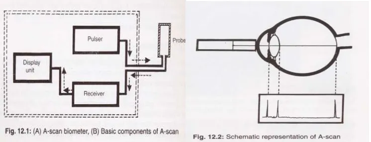 Gambar 1:  Komponen dasar dari  scan A (from fig 12.1 &12.2 ,Diagnostic 