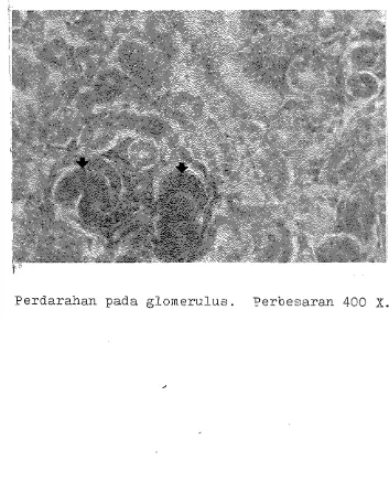 Gambar 7. Perdarahan pada glomerulus. Perbesaran 400 X. 
