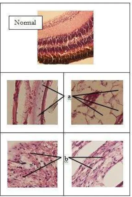 Gambar 7. Histopatologi mata Kerapu Tikus (Cromileptes altivelis) yang terinfeksi VNN (Viral Nervous Necrosis) dengan pewarnaan hematoksilin dan eosin yang dilihat menggunakan mikroskop cahaya perbesaran 400x