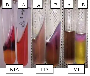 Gambar 1. Identifikasi bakteri dengan uji KIA, LIA , dan MIO dengan tabung (A)sebagai kontrol, dan tabung (B) sebagai sampel 
