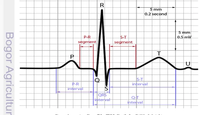 Gambar 1  Grafik EKG (McGill 2013) 