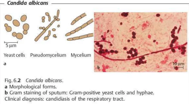 Gambar : Candida albican3