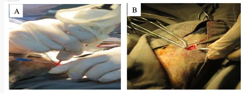 Gambar 2 Pemboran os tibia (A) operasi penanaman tandur (B) 