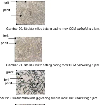 Gambar 22. Struktur mikro roda gigi cacing silindris merk TKB carburizing 1 jam. 