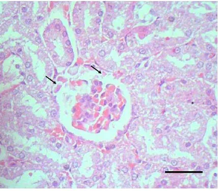 Gambar 11. Potongan melintang ginjal tikus yang mengalami kerusakan (Soeksmanto, 2006)