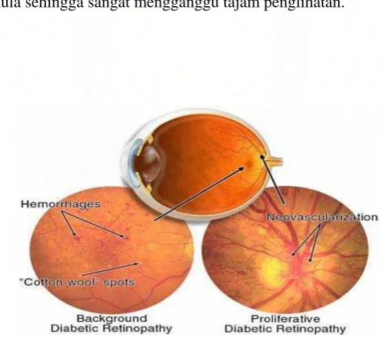 Gambar 2  