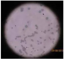 Gambar 7. Hasil uji sensitivitas S. aureus 