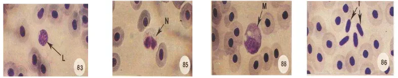 Gambar 3. Eritrosit dan jenis - jenis lekosit dalam darah ikan 