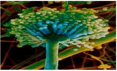 Gambar 7. Aspergillus niger (Dwidjoseputro, 2005).