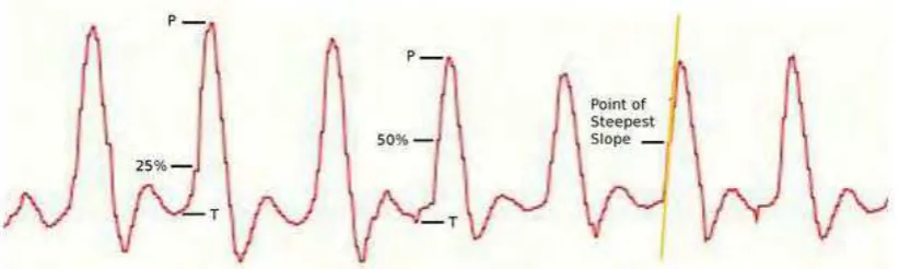 Figure 2.1: PPG waveform [18].  