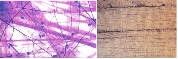 Gambar Jaringan ikat longgar (kiri) dan Jaringan Ikat Padat  (kanan)  (Biology, 2003)  