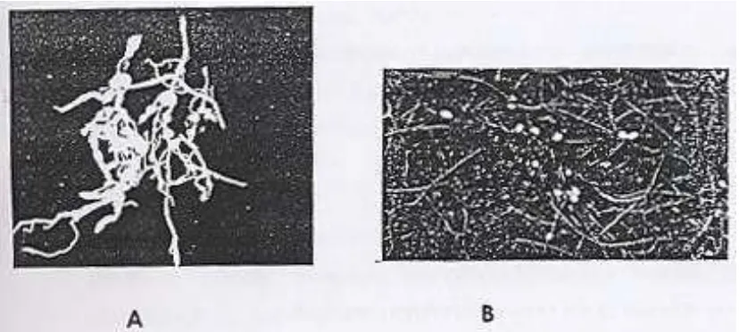 Gambar 1. Gejala serangan nematoda parasit tanaman A. Puru akar (Meloidogyne incognita) pada akar tomat  B