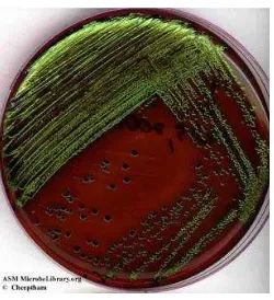 Gambar 1  Penampang media EMB yang ditumbuhi E. coli (Thrmo Fischer 