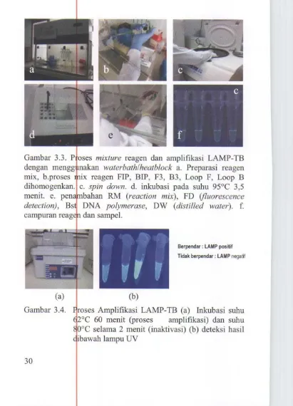 Gambar 3.3. Proses mixture reagen dan amplifikasi LAMP-TB