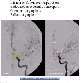 Gambar 1. Angiografi  cerebral, injeksi arteri karostis interna kiri ( Kiri ) pre – op; ( Kanan ) 7 hari setelah post op