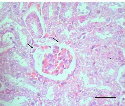 Gambar 6. Edema glomerulus pada ginjal tikus yang dikelilingi oleh tubulus yang mengalami degenerasi hidropis (Suyanti, 2008)