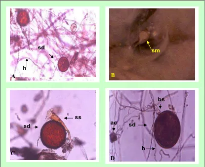 Gambar 9.   Spora-spora yang berkembang dalam kultur spora tunggal dengan teknik PDOC dari jenis Glomus (A), Acaulospora (B dan C) dan Gigaspora (D): sd = spora dewasa, h = hifa, sm = spora muda, ss = sporiferous saccule, bs = bulbous suspensor, ac = auxil
