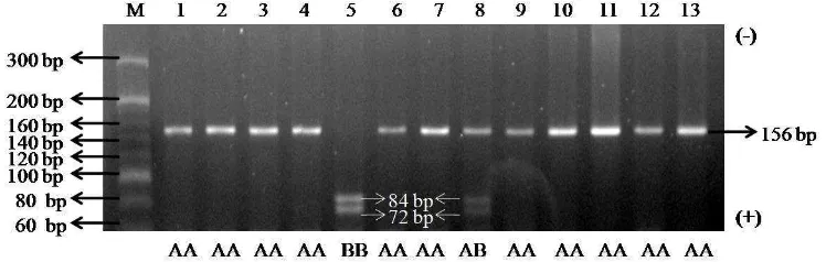 Gambar 9  Hasil PCR-RFLP fragmen gen PRL ekson 3 dengan enzim restriksi RsaI pada gel agarosa 3.5%