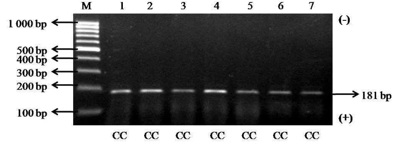 Gambar 10  Hasil PCR-RFLP fragmen gen PRL ekson 4 dengan enzim restriksi RsaI pada gel agarosa 2%
