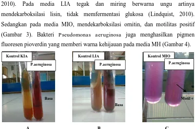 Gambar 2. Hasil identifikasi biokimia bakteri Proteus mirabilisKeterangan : (A) Media KIA, (B) Media LIA, (C) Media MIO  