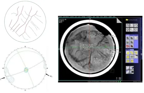 Figure 6. Structural geology (folds, faults and cleats) arrangements in Berau Basin and CT scan image of representative coal samples 