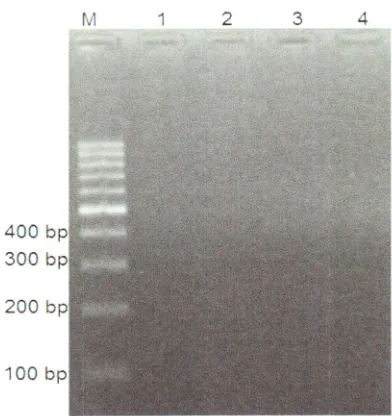 Fig. 3 Amplificaporcine porcine affected equipments after ritual purifi100 tion of specific DNA fragments of cyl b on cation