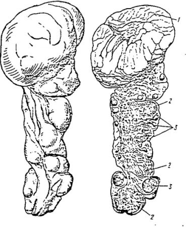 Gambar  10.  Ovariurn  utuh.(kiri)  dan  irisan  melintang  (ka- (ka-nan)  dari  Balaenoptera  physalus 