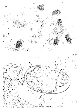 Gambar 3. Telur Stephanurus dentatus 