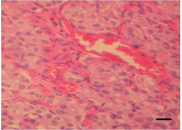 Gambar 8     Deskuamasi sel epitel usus halus tikus. Pewarnaan HE, bar 30 µm. 