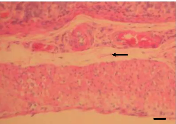 Gambar 10   Akumulasi sel radang usus halus tikus (panah). Pewarnaan HE,     bar 30 µm