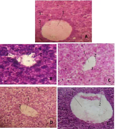 Gambar 2.  Foto mikroskopis jaringan hati fetus dari induk setelah perlakuan dengan warfarin dan vitamin A dimana; A)