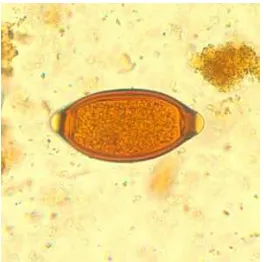 Gambar 3. Telur Trichuris trichiura (CDC, 2009) 