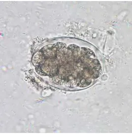 Gambar 5. Telur cacing tambang (hookworm) (CDC, 2010)  