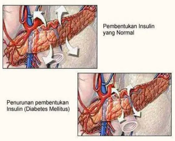 Gambar 1 Sekresi insulin 