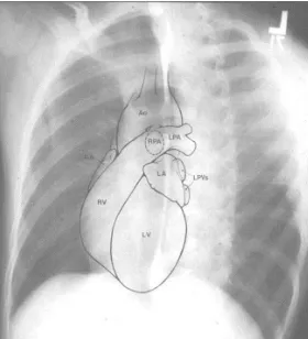 Gambar 3.  Ruang ruang jantung pada foto left anterior oblique 