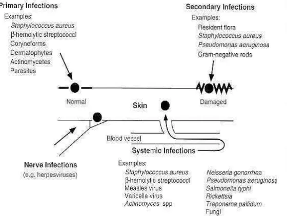 Gambar 1. Penyebaran infeksi pada kulit 