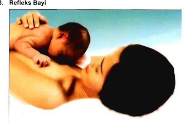 Gambar 3.4. Refleks Bayi 