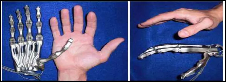 Figure 2.5:  Design of bionic hand by W. Widhiada [5] 