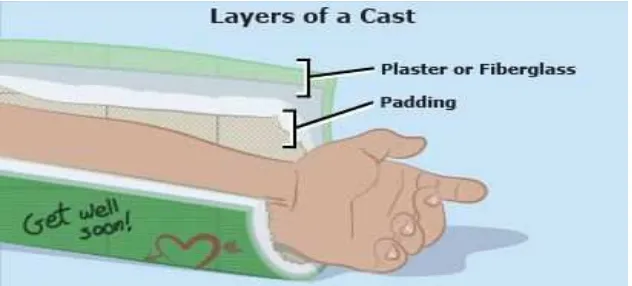 Figure 1.3: Layer of cast 
