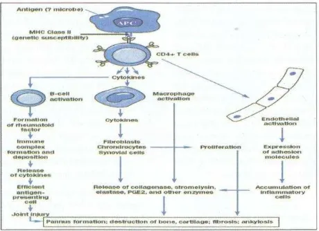 Gambar 4. Patofisiologi artritis reumatoid  (Suarjana, 2009) 