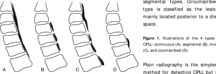 Figure 1. Illustrations of the 4 types of  